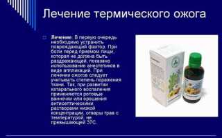 Чем лечить ожог