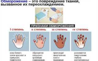 Первая помощь при обморожении рук