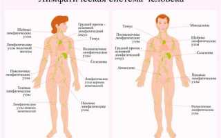 Лечение лимфомы: эффективные методы и стратегии
