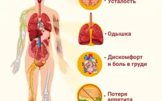 Симптомы сердечной недостаточности