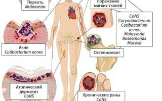 Что такое микрофлора кожи и как ухаживать за ней