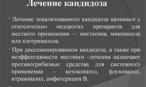 Как лечить мужскую молочницу