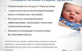 Универсальные способы избавления от диатеза у детей