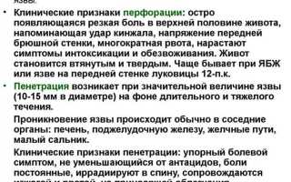 Прободение язвы: симптомы и лечение