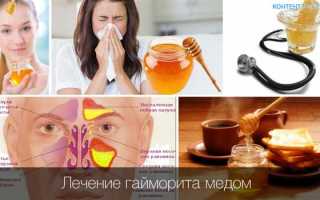 Как самостоятельно лечить гайморит у детей дома?