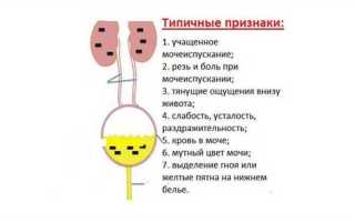 Что делать, если писать больно?