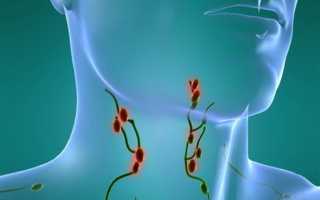 Как вылечить лимфоузлы на шее