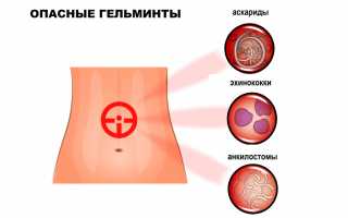 Симптомы глистов: как распознать и как лечить