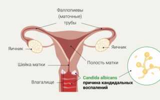Важные правила лечения грибка рода кандида