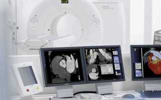 Что такое КТ?