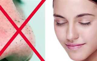 Как избавиться от прыщей за неделю