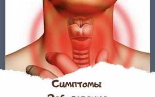 Симптомы заболевания щитовидной железы