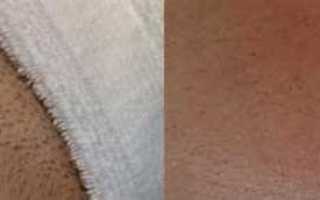 В упорных усилиях избавиться от неприятных темных пятен между ног: советы и рекомендации