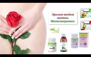 Как использовать народные средства для лечения эрозии шейки матки и повышения эффективности терапии