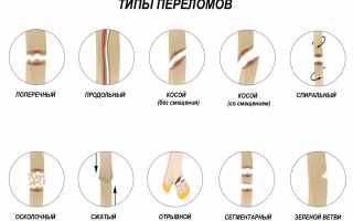 Переломы и их симптомы