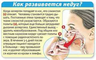 Почему ночью закладывает нос