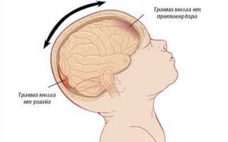 Ушиб головы, опасно ли это