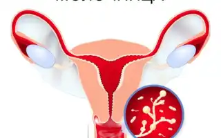 Как избавиться от дрожжей