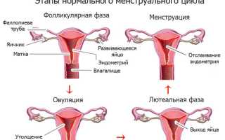 Месячные обильные со сгустками: причины и методы лечения