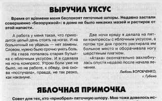 Лечение шпор на пятке