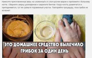 Как избавиться от грибка стопы в домашних условиях