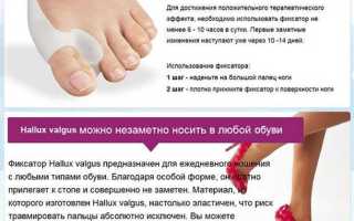 Как лечить косточки у большого пальца ноги