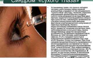Методы лечения синдрома сухих глаз