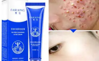 Как вылечить прыщи на лице