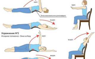 Как избавиться от межреберной невралгии