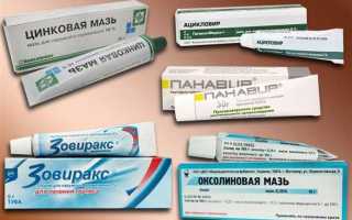 Как лечить герпес на губах: эффективные таблетки