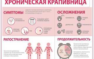 Как лечить аллергические высыпания на коже