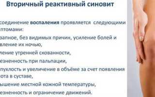 Как лечить синовит коленного сустава