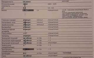 О чем сигнализируют эритроциты в моче у ребенка