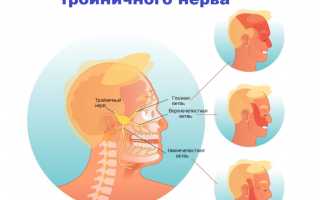 Лечение троичного нерва