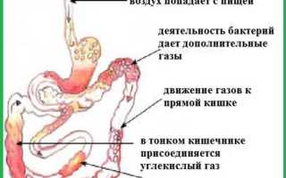 Как избавиться от газов в желудке