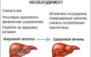 Гепатоз жировой лечение
