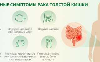 Симптомы рака прямой кишки