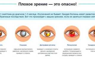 Методы восстановления зрения после сварки и электрофотоофтальмии