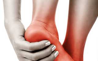 Как избавиться от боли в стопах