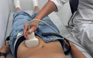 Ультразвуковое исследование во время беременности и у мужчин