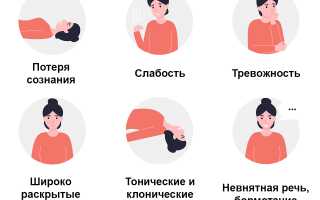 Симптомы эпилепсии