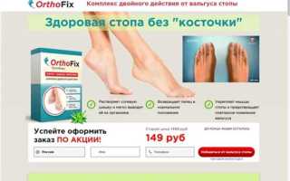 Как лечить кости на ногах