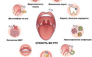 Как лечить сухость во рту