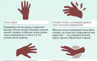 Перелом руки, симптомы и методы лечения