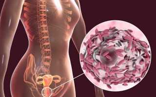 Как лечить кольпит у мужчин