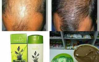 Как выбрать шампунь от облысения