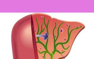 Как освободиться от застоя желчи и улучшить работу желчевыводящих путей