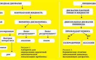 Что такое дисфагия: причины возникновения и лечение
