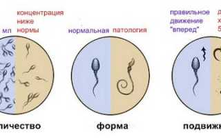 Что такое астенозооспермия и как ее лечить