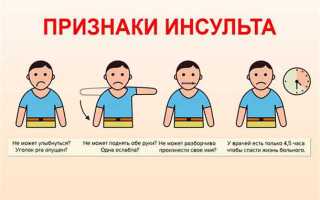 Шесть симптомов инсульта у мужчин, который должны знать все